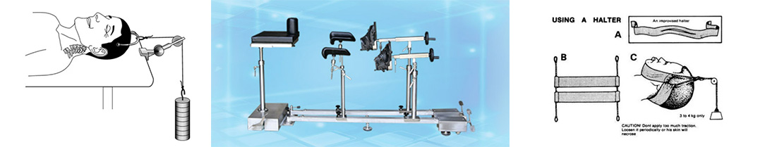 Medical Field - AI-Driven Orthopedic Traction